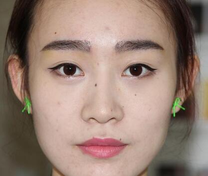 種植眉毛后二年圖片