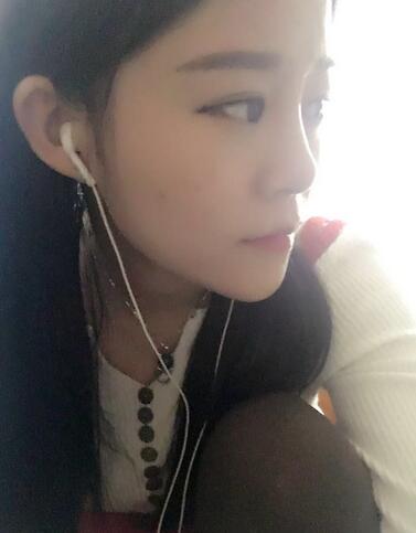 玻尿酸隆鼻恢復(fù)過程圖