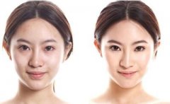 水光補(bǔ)水是什么、水光補(bǔ)水果好不好