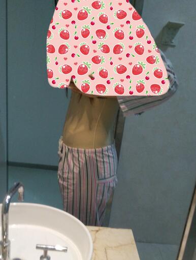 腰腹抽脂3個(gè)月的感受