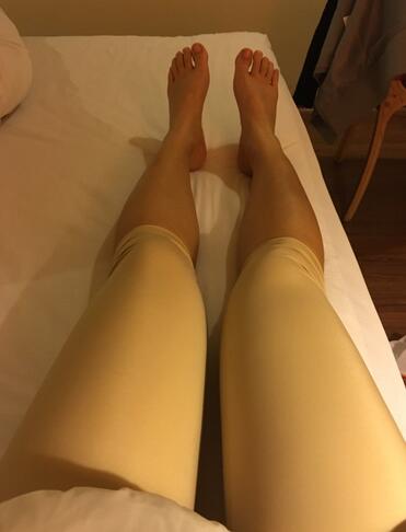 重慶好美自體脂肪隆胸已經(jīng)一個(gè)月了