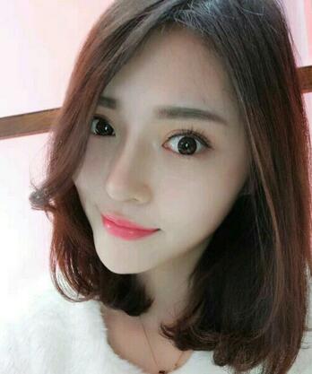 隆鼻整形1個(gè)月真實(shí)恢復(fù)期圖片