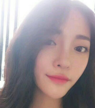 隆鼻整形1個(gè)月真實(shí)恢復(fù)期圖片