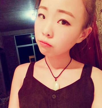 割雙眼皮術(shù)后恢復(fù)過程 全切雙眼皮3個月