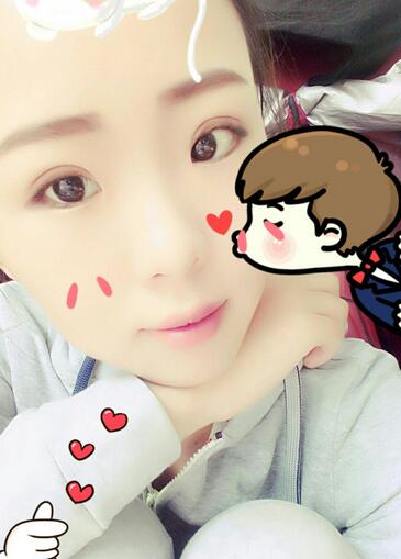 割雙眼皮術(shù)后恢復(fù)過程 全切雙眼皮3個月