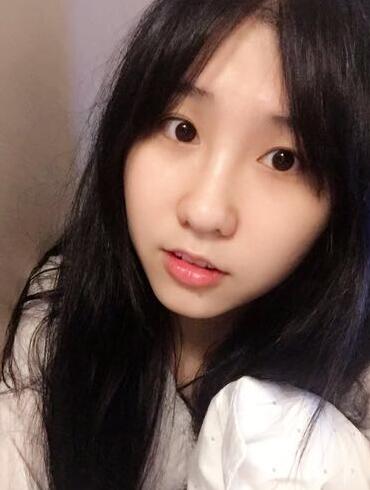 切的雙眼皮90天恢復(fù)過(guò)程圖