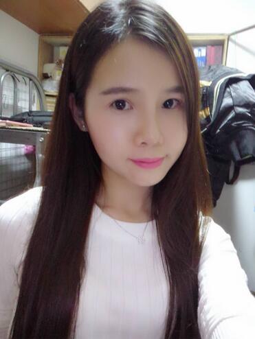 自體脂肪填充后2個月圖