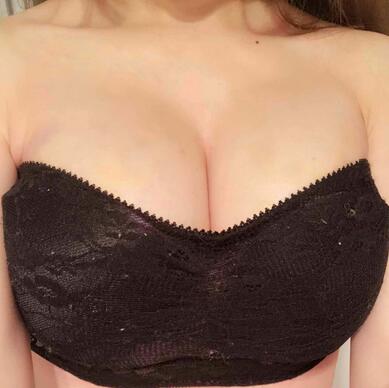 自體脂肪豐胸之后多久能上班 北京麗星豐胸恢復(fù)紀(jì)實(shí)