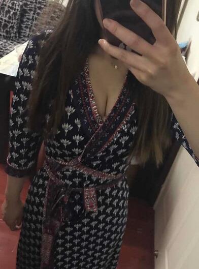 自體脂肪豐胸之后多久能上班 北京麗星豐胸恢復(fù)紀(jì)實(shí)