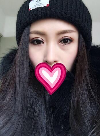 北京麗星雙眼皮修復(fù)半年了