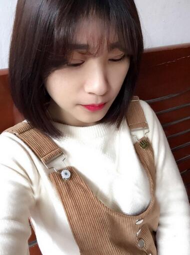 微創(chuàng)定點(diǎn)每天恢復(fù)過程圖 北京麗星雙眼皮3個月