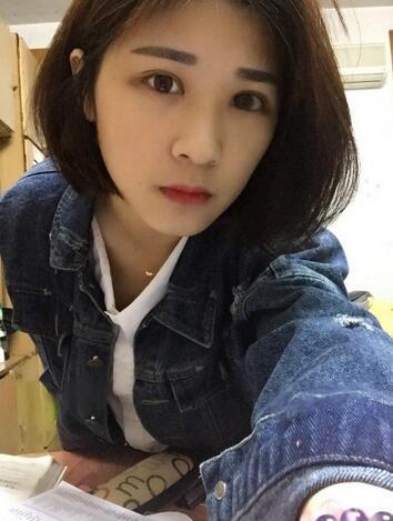 微創(chuàng)定點(diǎn)每天恢復(fù)過程圖 北京麗星雙眼皮3個月