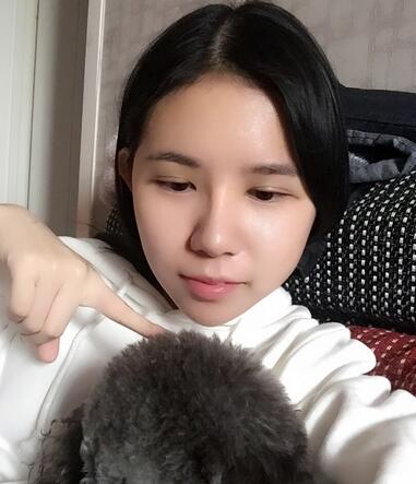 自體脂肪填充恢復(fù)日志 自體脂肪填充太陽穴+額頭