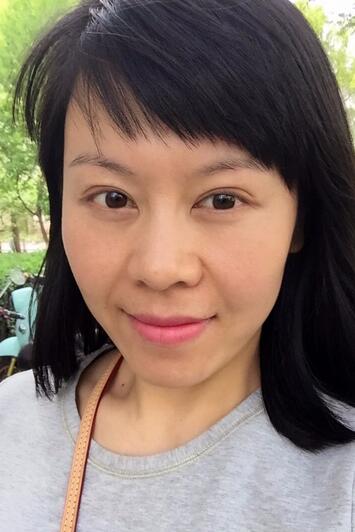 面部埋埋蛋白線.提升恢復(fù)過(guò)程分享