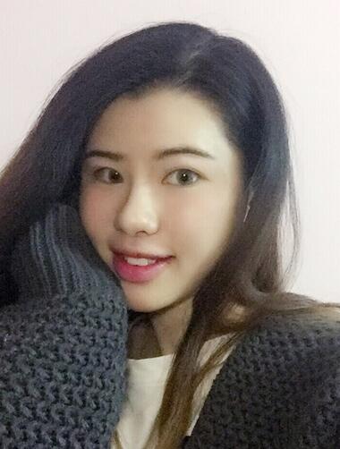 切開(kāi)重瞼術(shù)恢復(fù)過(guò)程圖