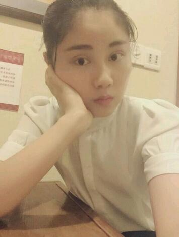 全切雙眼皮半年恢復(fù)過(guò)程圖