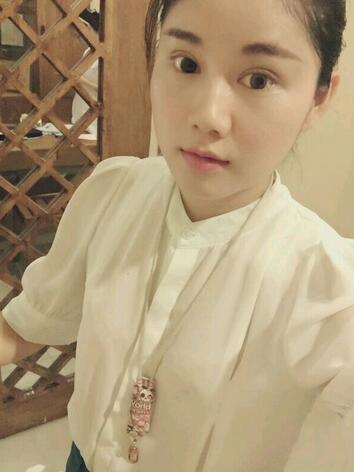 全切雙眼皮半年恢復(fù)過(guò)程圖