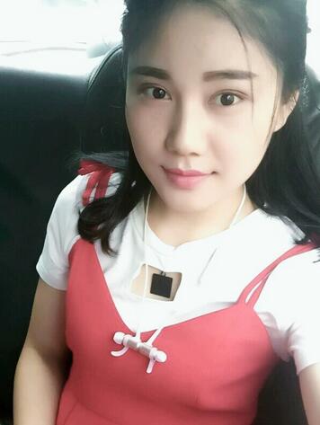 全切雙眼皮半年恢復(fù)過(guò)程圖