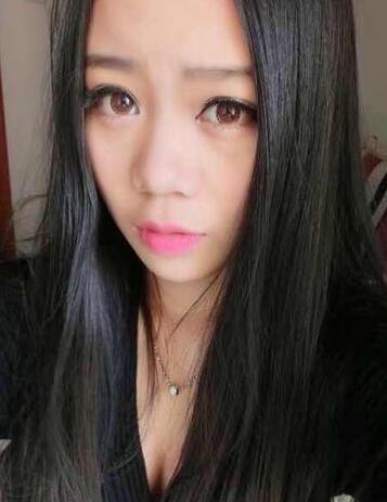 隆鼻拆線后鼻子圖片 硅膠隆鼻+鼻翼縮小恢復經(jīng)歷