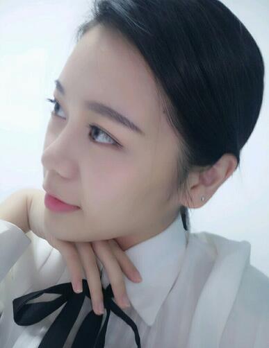 隆鼻拆線后鼻子圖片 硅膠隆鼻+鼻翼縮小恢復經(jīng)歷