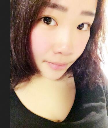 耳軟骨墊鼻尖三個(gè)月圖 耳軟骨墊鼻尖+硅膠隆鼻