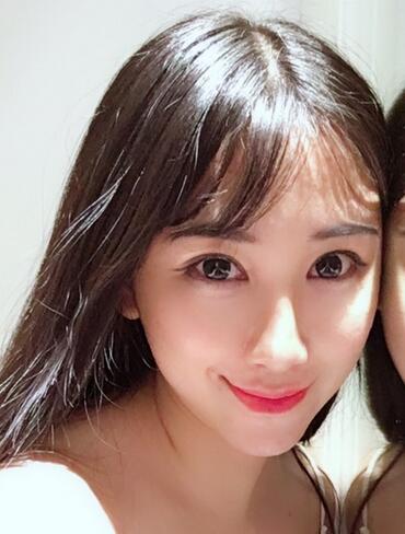 做完光子嫩膚恢復(fù)圖片 果滿滿