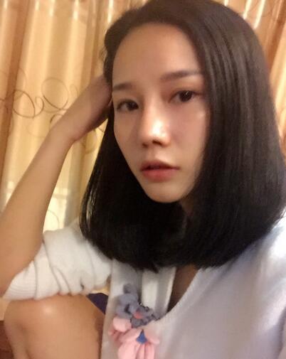 隆鼻整形真實(shí)恢經(jīng)歷 曬圖啦！