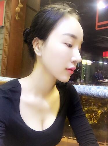 鼻修復后的恢復期經(jīng)歷分享