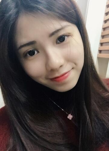 廣州凱美達(dá)微創(chuàng)雙眼皮手術(shù)恢復(fù)期紀(jì)實(shí)