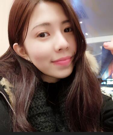 廣州凱美達(dá)微創(chuàng)雙眼皮手術(shù)恢復(fù)期紀(jì)實(shí)