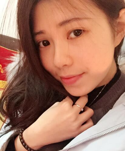 廣州凱美達(dá)微創(chuàng)雙眼皮手術(shù)恢復(fù)期紀(jì)實(shí)