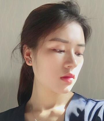 廣州凱美達微創(chuàng)雙眼皮手術(shù)恢復期紀實