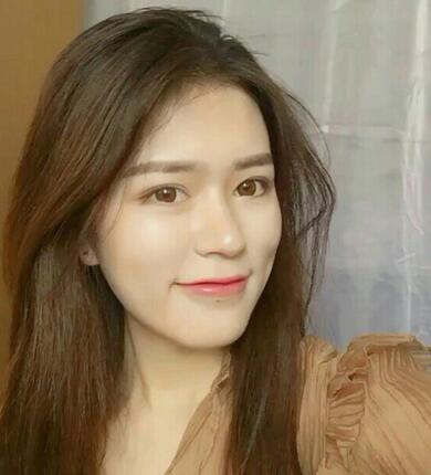 廣州凱美達微創(chuàng)雙眼皮手術(shù)恢復期紀實