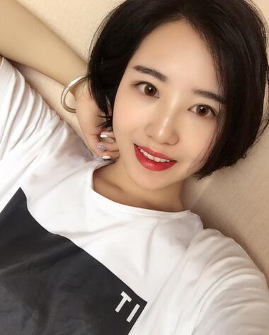 武漢憶美凱德去眼袋手術(shù)后兩個月照片