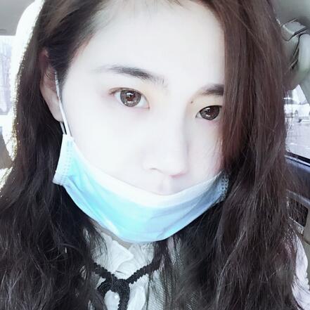 武漢樂美開眼角+雙眼皮3個月恢復圖片