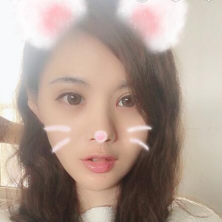 武漢樂美開眼角+雙眼皮3個月恢復圖片