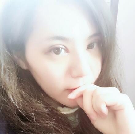 武漢樂美開眼角+雙眼皮3個月恢復圖片