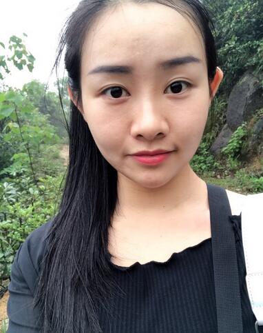 武漢樂美韓式微創(chuàng)雙眼皮+開內眼角