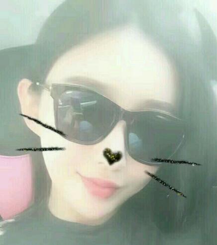 武漢西嬋康美假體隆鼻+眼部綜合整形