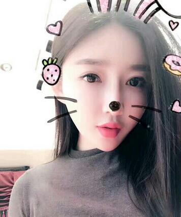 武漢西嬋康美假體隆鼻+眼部綜合整形