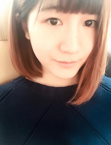 杭州王圣林全切雙眼皮恢復(fù)過(guò)程圖