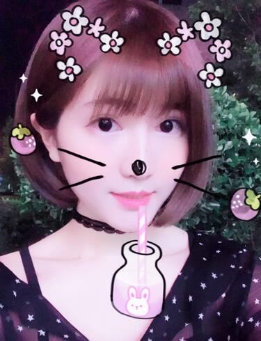 杭州王圣林全切雙眼皮恢復(fù)過(guò)程圖