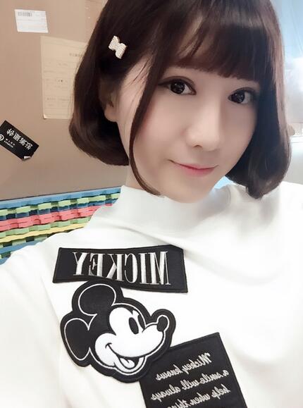 杭州王圣林全切雙眼皮恢復(fù)過(guò)程圖