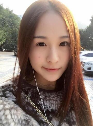 杭州大麥微針龍都整形開眼角+割雙眼皮恢復(fù)記錄