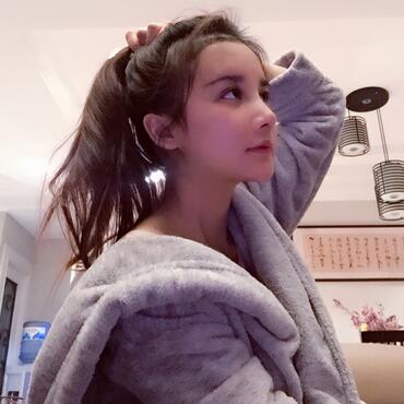 發(fā)際線調(diào)整果對(duì)比圖 杭州大麥微針龍都發(fā)際線種植