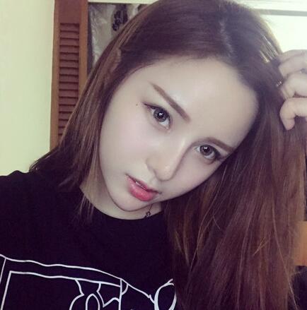 北京八大處李戰(zhàn)強(qiáng)隆鼻案例