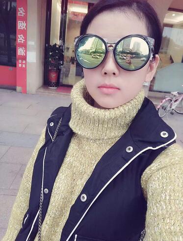 北京八大處辛敏強(qiáng)做雙眼皮怎么樣 案例分享