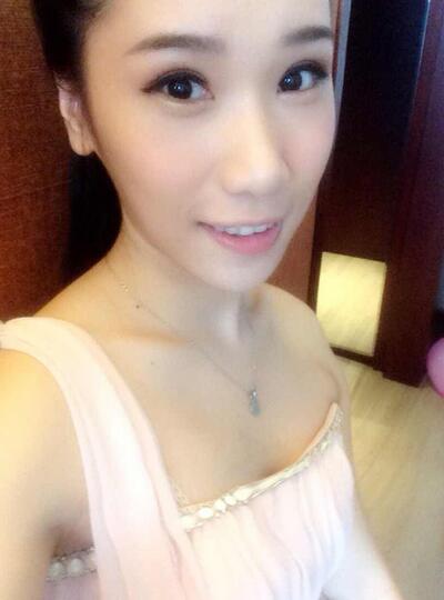 自體脂肪隆胸一個(gè)月后 北京葉子做的