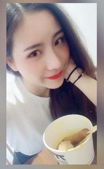 北京藝星王英勇隆鼻案例 隆鼻整形三個(gè)月