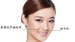 成都去抬頭紋大概需要多少錢(qián)？怎樣有去除抬頭紋？